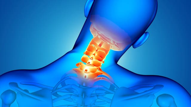 Boyun yırtığı niyə əllərdə keyimə yaradır? - Fizioterapevt açıqlayır