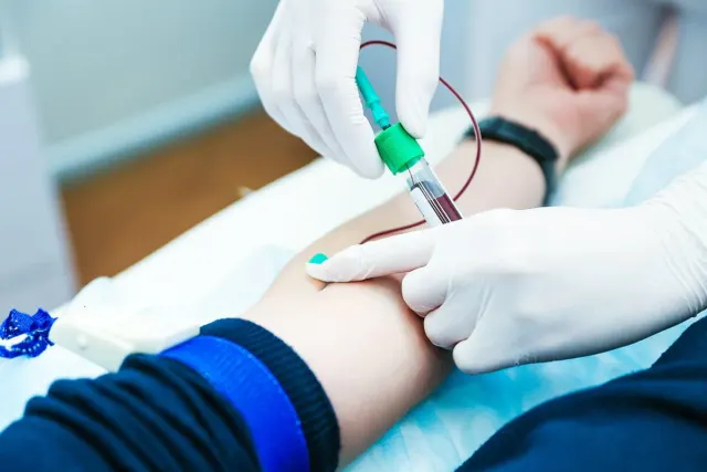 Analiz verməzdən əvvəl spirtli içki qəbulu təhlükəlidir – həkim xəbərdarlıq edir