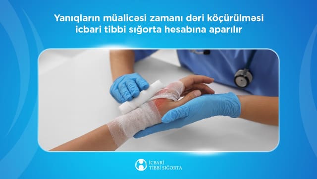 Yanıqların müalicəsi icbari tibbi sığorta hesabına həyata keçirilir