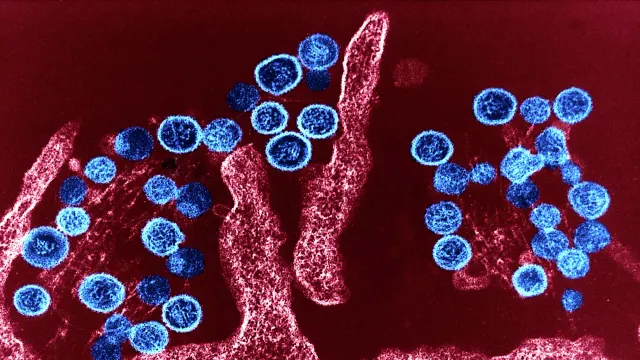 Hantavirus nədir? Simptomları nələrdir? - AÇIQLAMA