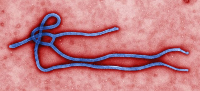 Ebola qurbanlarının sayı 492-yə çatdı