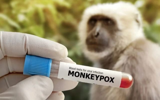 Honkonqda meymunçiçəyinə yeni yoluxma halları aşkarlanıb