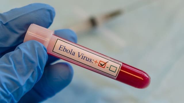 Keniyada Ebola virusuna 4 yeni yoluxma qeydə alınıb
