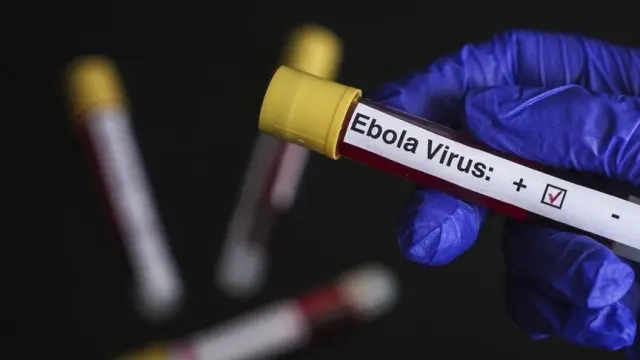 Konqoda Eboladan ölənlərin sayı 4500-ü keçib