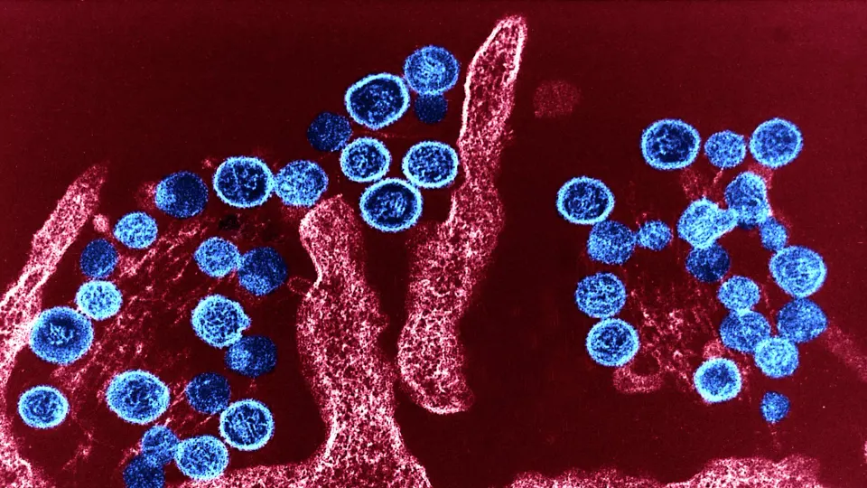 Hantavirus nədir? Simptomları nələrdir? - AÇIQLAMA