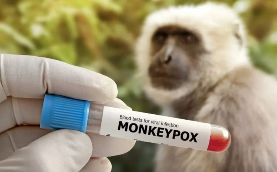 Honkonqda meymunçiçəyinə yeni yoluxma halları aşkarlanıb