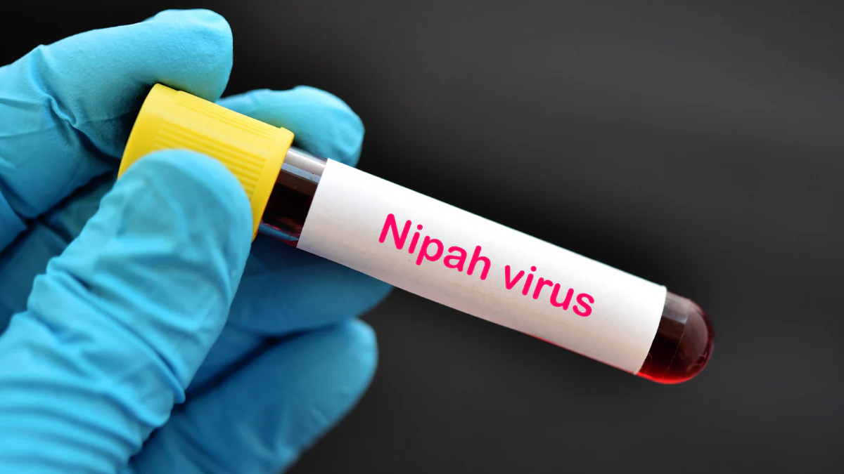 Qırğızıstan Nipah virusu səbəbindən Hindistandan mal-qaranın idxalını məhdudlaşdırıb