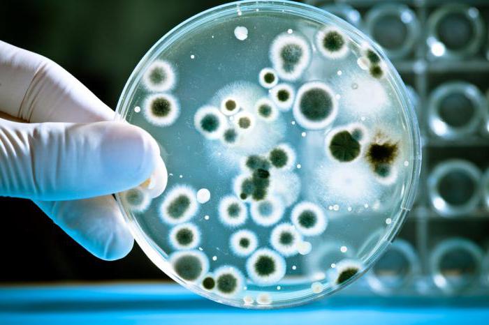 Brusellyoz xəstəliyinə görə seroloji monitorinqlər keçiriləcək