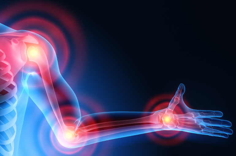 Yağışla havalarda revmatizm xəstələri nələrə diqqət etməlidir?