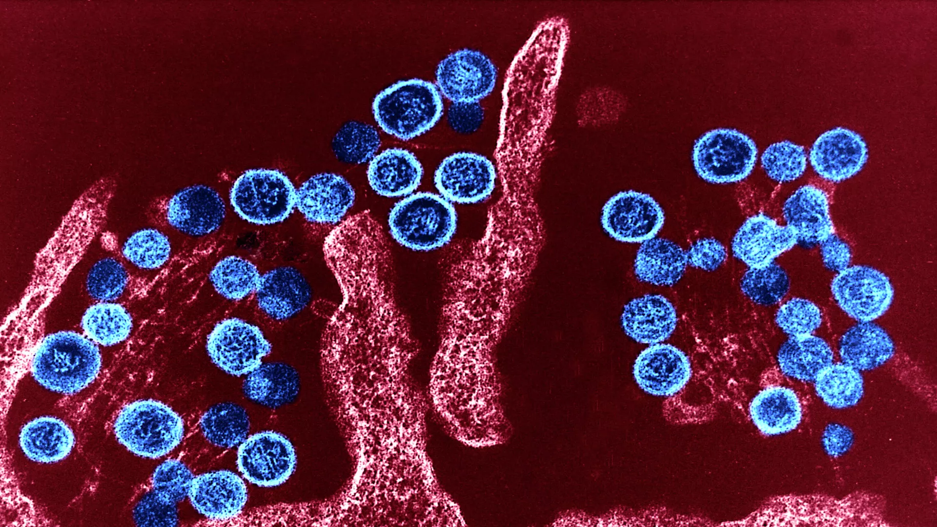 Hantavirus nədir? Simptomları nələrdir? - AÇIQLAMA