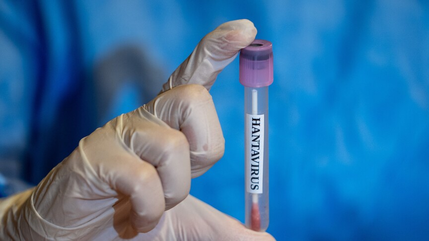 Gəmidən təxliyə edilən Türkiyə vətəndaşlarının hantavirus test nəticələri neqativ çıxıb