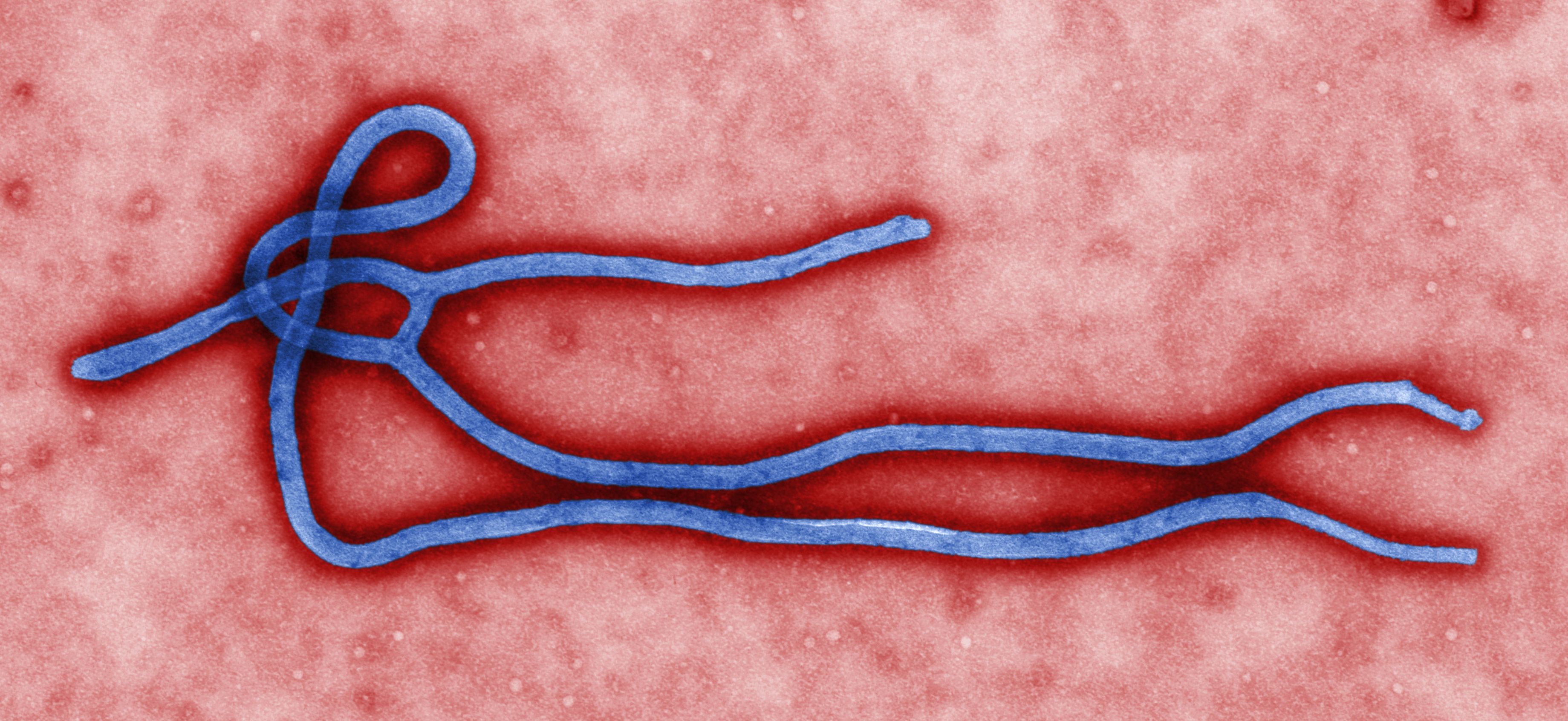 Ebola qurbanlarının sayı 492-yə çatdı