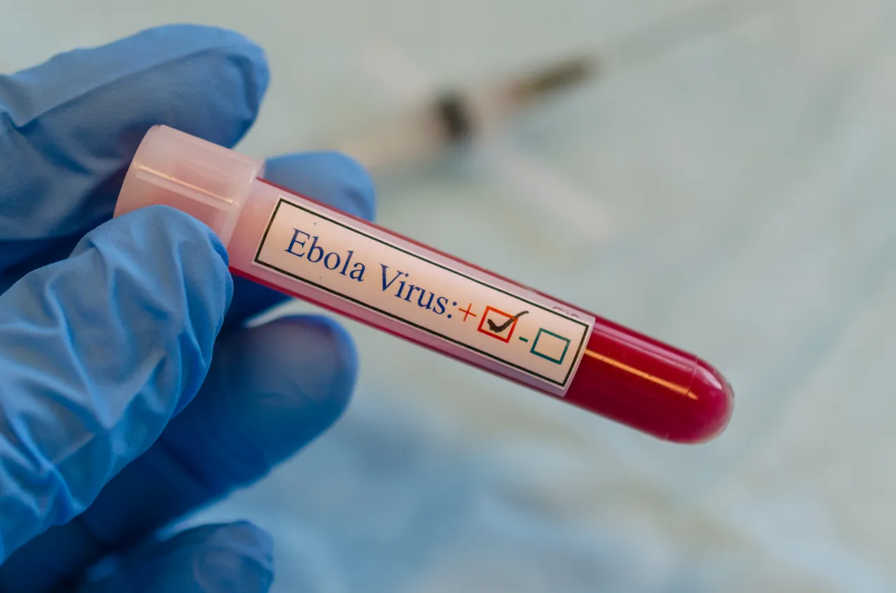 Ebola virusundan ölənlərin sayı artıb