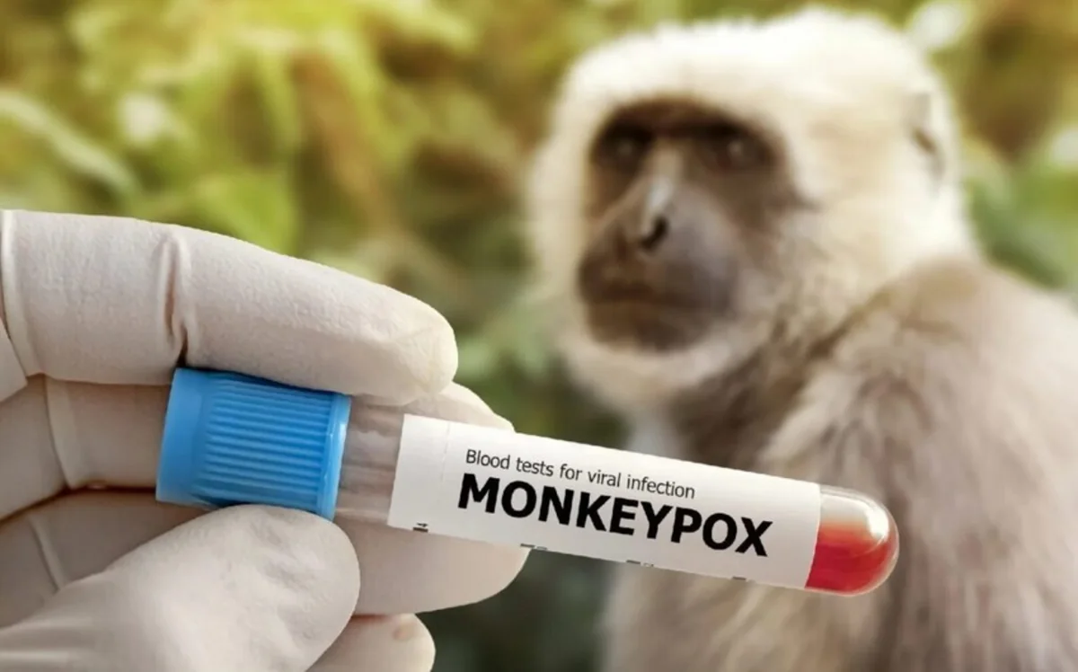 Honkonqda meymunçiçəyinə yeni yoluxma halları aşkarlanıb