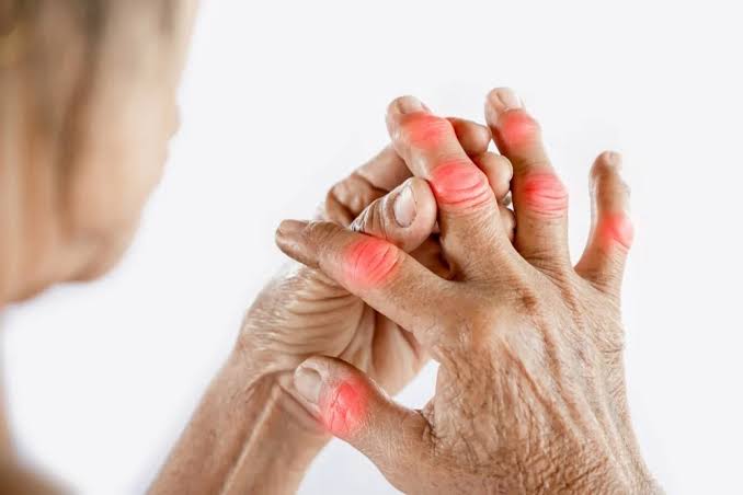 Revmatoid artritlə yaşayanlar nələrə diqqət etməlidir?  - Həkim danışır